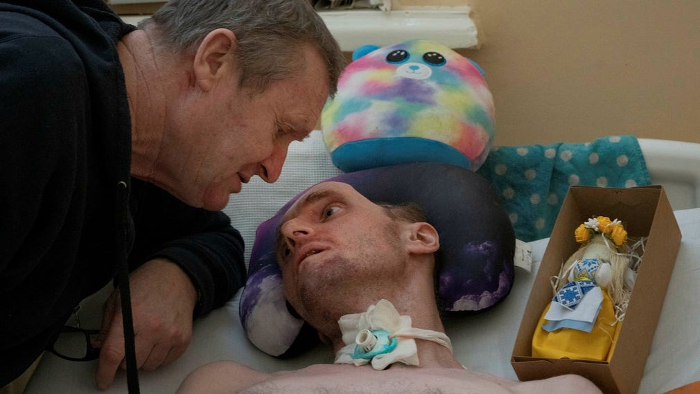 Vitaly, 34 anni, è rimasto ferito in un attacco con granate nell'est dell'Ucraina ad agosto.