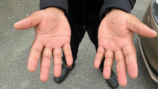 One of the neighbors shows the hands that have now been washed from the blood after the attempts to save the woman.