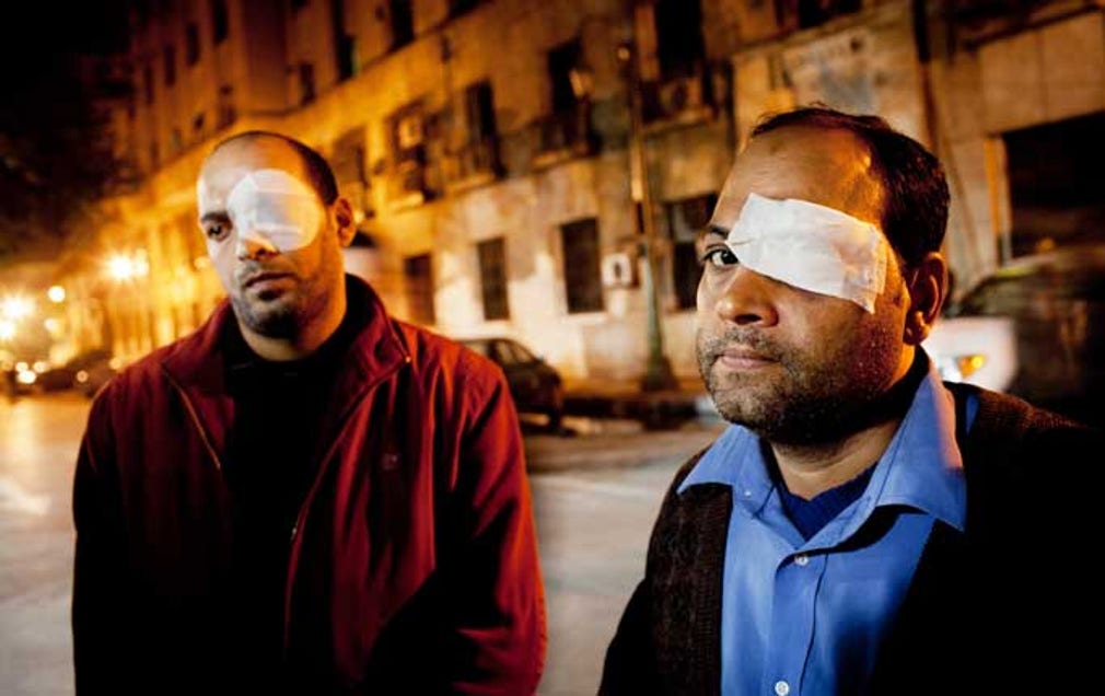 Ashraf Mohammed och Wael Ahmed har drabbats av den senaste tidens våld. Båda blev beskjutna av polisen med gummikulor och än är det oklart om deras syn går att rädda.