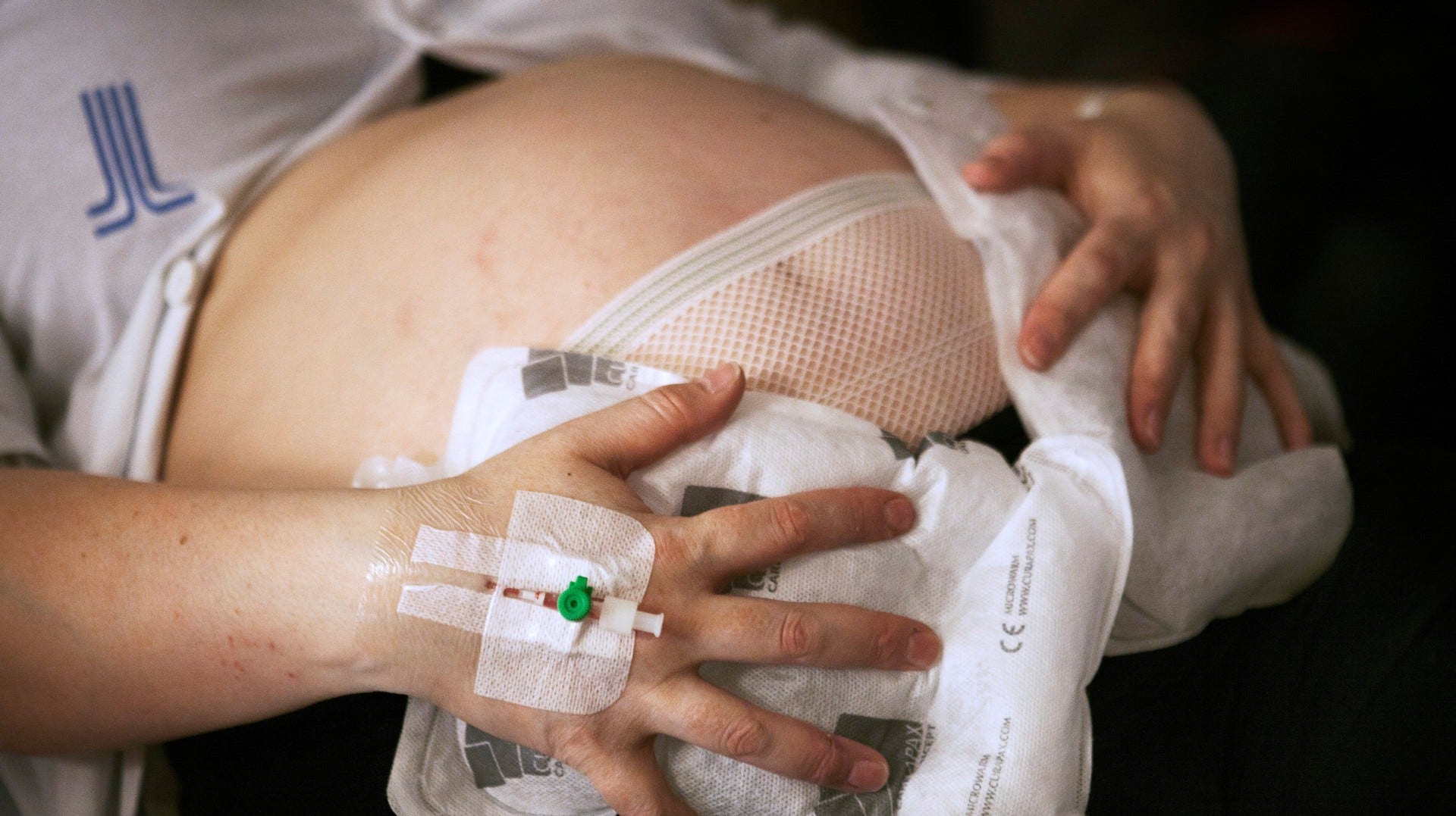 Den nedåtgående spiralen inom förlossningsvården är ett faktum sedan många år. Lösningen ligger i att anställa fler barnmorskor, det hjälper inte att anställa mer vårdpersonal inom andra kategorier, skriver artikelförfattaren.