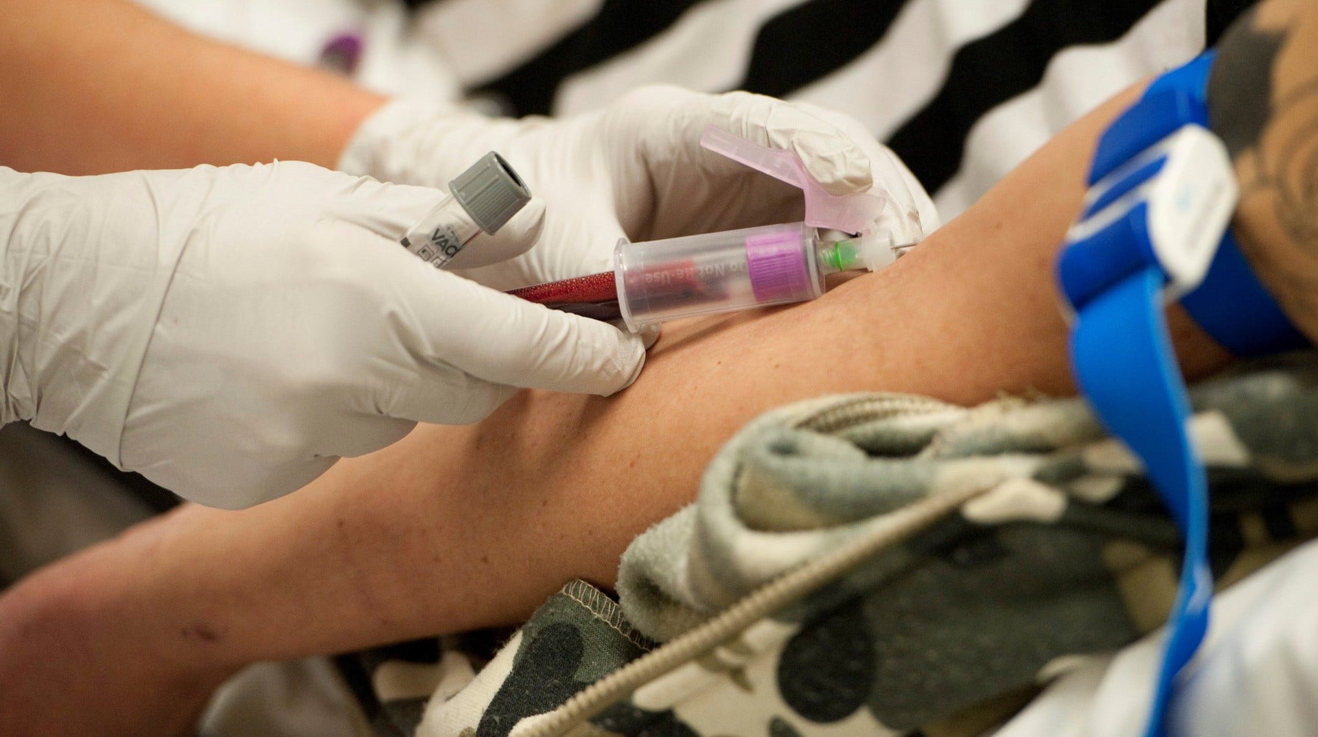Om patienten samtycker sparas vissa medicinska prover i en biobank, vilken är viktig för forskning. Nu måste lagen som reglerar biobanken moderniseras, skriver artikelförfattarna.