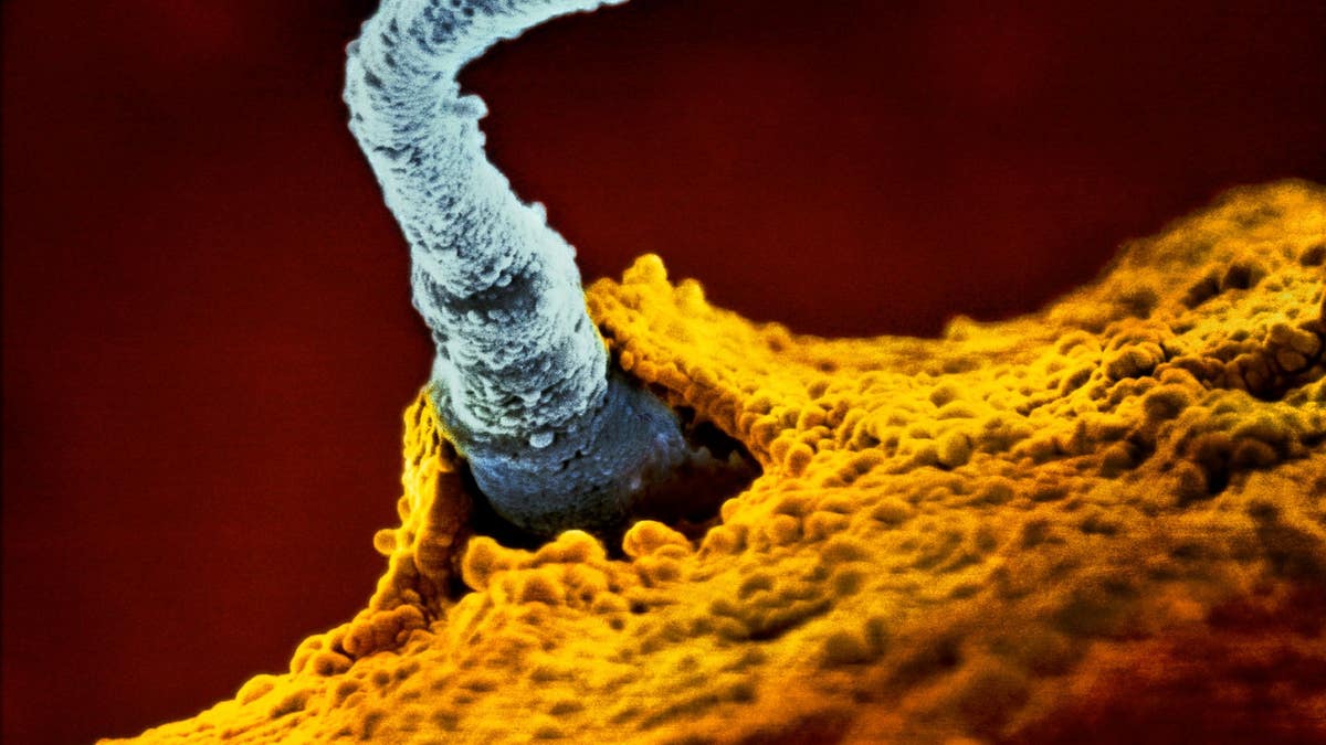 Оплодотворение яйцеклетки микроскоп